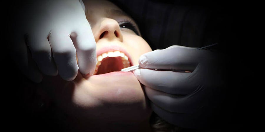Oral Surgery Brampton